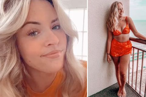 Tiktok: Junge Frau zeigt ihren Körper nach schwerem Corona-Verlauf – und erntet fiesen Shitstorm