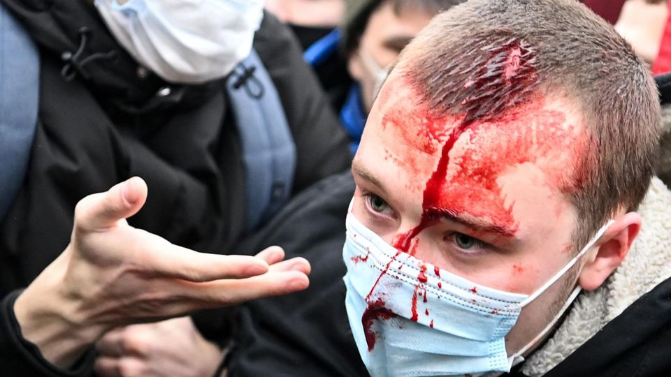 Russland Demo Blut Demonstrant Platzwunde Einem jungen Mann mit kurzen, dunkelblonden Haaren läuft aus einer Platzwunde auf dem Kopf Blut über Gesicht und Mundschutz