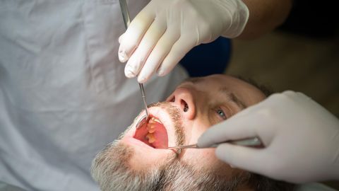 Ein Mann beim Zahnarzt