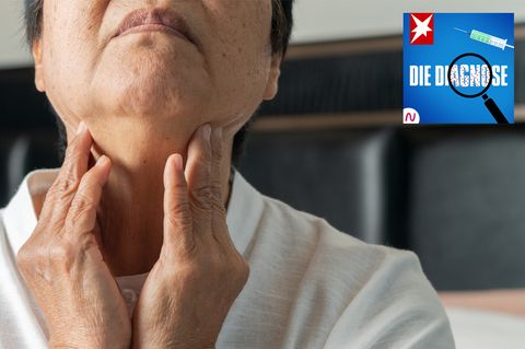 Diagnose-Podcast: Eine Frau leidet unter Schluckproblemen – schuld ist ihre Muskelkraft