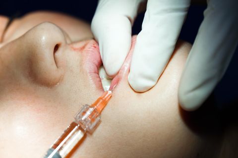 Corona-Trend Schönheits-OPs