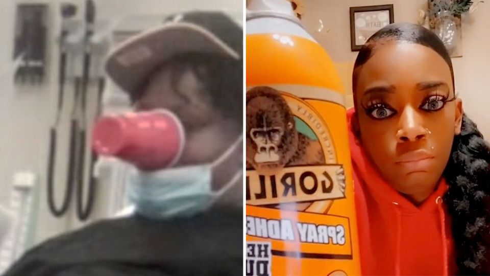 Mann klebt sich Kaffeebecher mit Sekundenkleber ins Gesicht – weil er Influencerin nicht glaubt