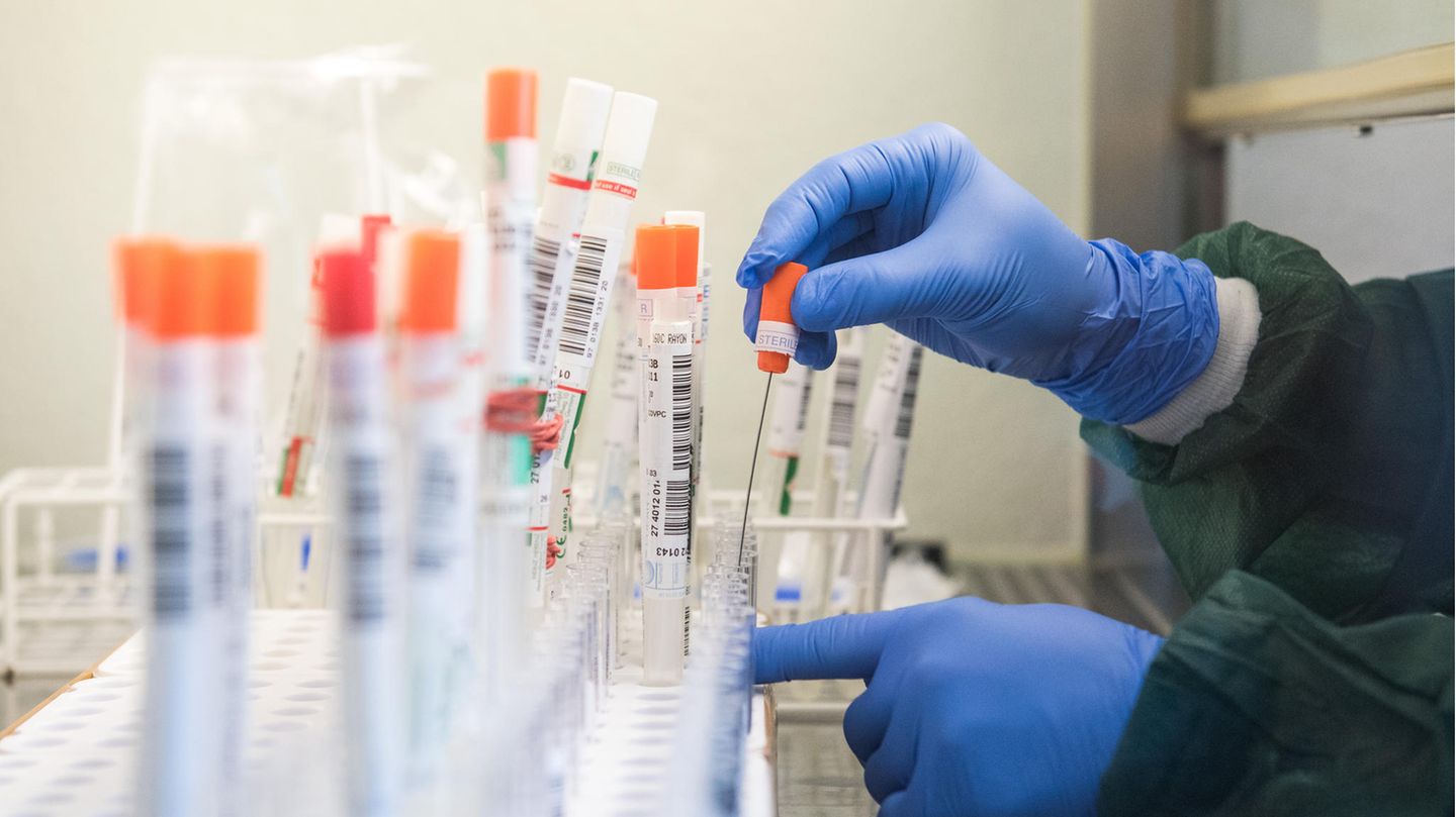 Eine Labor-Mitarbeiterin überführt einen trockenen Abstrich eines Tests auf das Sars-CoV-2-Virus in eine Flüssigkeit