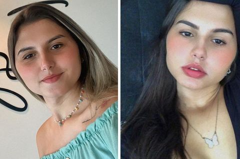 Sofia Albuquerck (l.) und ihre eineiige Zwillingsschwester Mayla Rezende (r.) nach ihrer geschlechtsangleichenden Operation