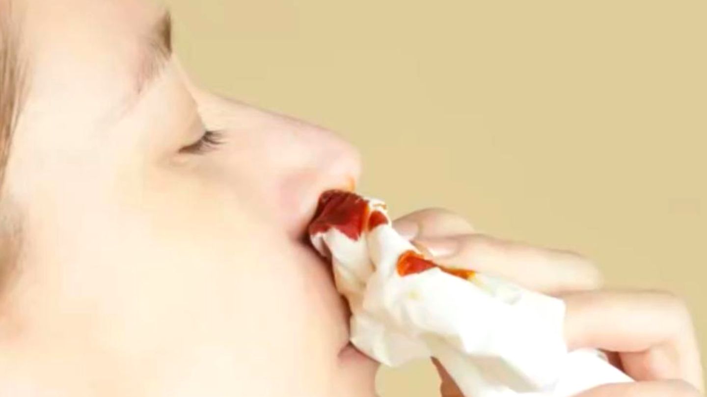 “Blood can flow to the stomach or lungs” – paramedic shows how to properly treat nosebleeds (video)