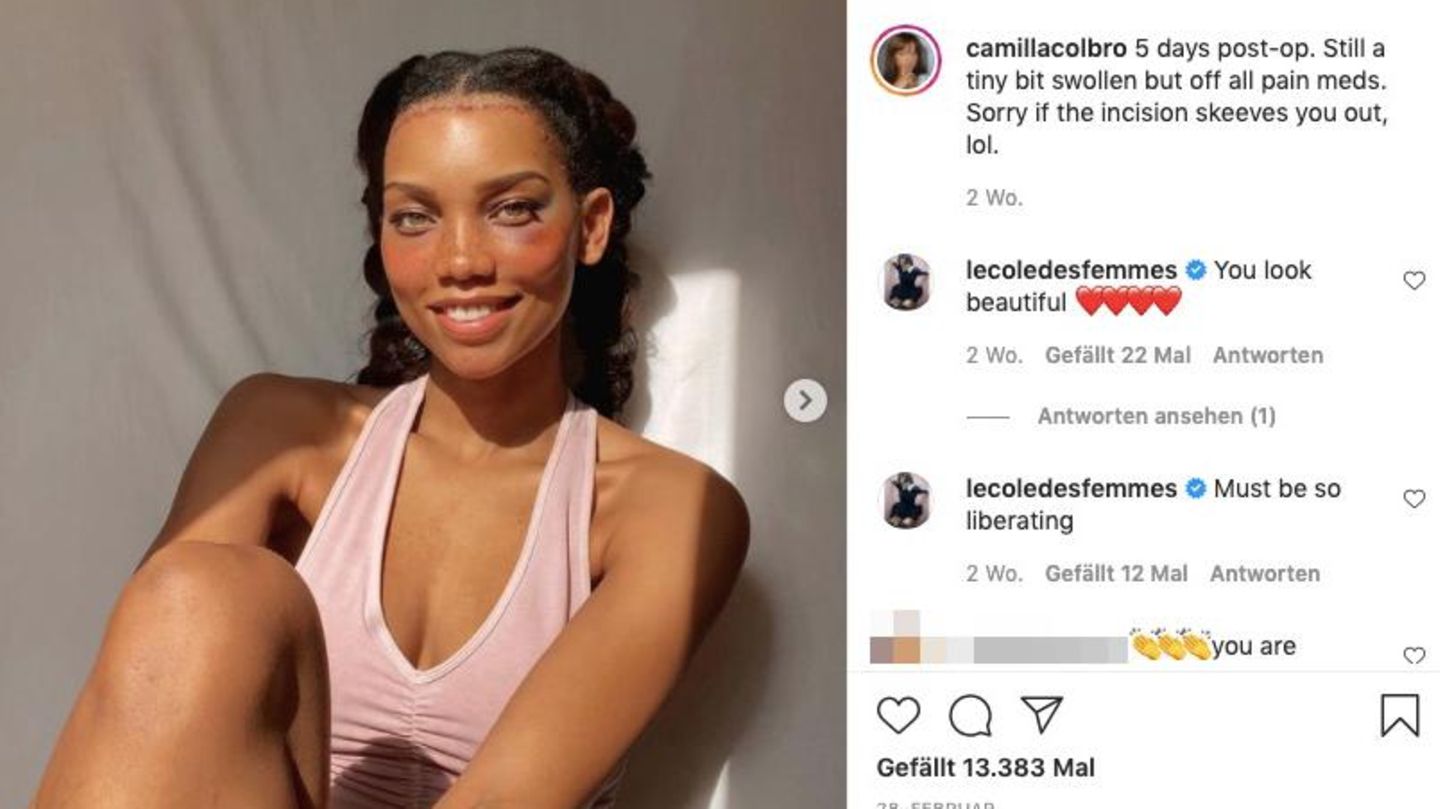 Camilla nach ihrer OP