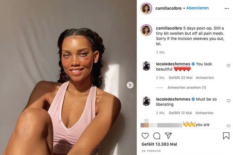 Camilla nach ihrer OP