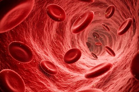 Hirnvenenthrombosen