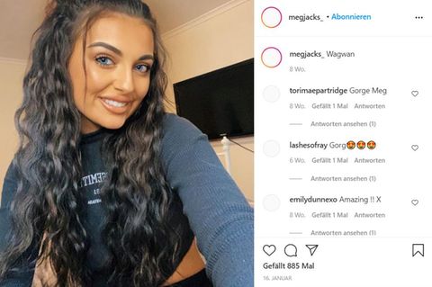Megan Jackson möchte in den sozialen Medien auf ihre Störung aufmerksam machen. 