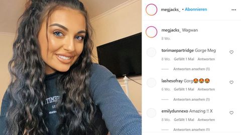 Megan Jackson möchte in den sozialen Medien auf ihre Störung aufmerksam machen. 