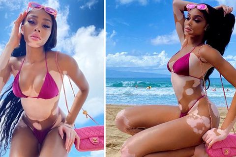 Sehnsucht nach Urlaub garantiert: Winnie Harlow zeigt ihre Kurven – im Bikini