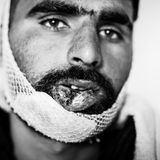 "Berichte über Misshandlungen und brutale Push-Backs durch Beamte des EU-Staats Kroatien gab es schon vor meiner Recherche. Es war bekannt, dass dort Verbrechen passieren. Aber in der deutschsprachigen Presse war kaum etwas darüber zu lesen. Das hat mich geärgert. Darum habe ich mich entschieden, diese Verbrechen mit der Kamera zu dokumentieren. In den Lagern habe ich dann gezielt nach Menschen gesucht, die an der Grenze misshandelt worden waren. Ich wollte Bilder machen, die als Beweise dienen können.  Der Mann auf dem Bild heißt Mohammed Fiaz, er ist 24 Jahre alt und stammt aus Pakistan. Fünf Tage bevor ich ihn fotografierte und seine Geschichte protokollierte, hatten kroatische Polizisten ihm den Kiefer gebrochen und mehrere Zähne ausgeschlagen. Dann hatten sie ihm Jacke und Schuhe abgenommen. Sieben Kilometer musste er barfuß zurücklaufen nach Bosnien hinein. Als ich ihn traf konnte Fiaz kaum sprechen. Andere Flüchtlinge hatten mich zu ihm gebracht. Während ich sein Portrait aufnahm, umringten sie uns und sagten: "Du musst das fotografieren. Wir wollen, dass publik wird, was hier passiert."  Ich bin kein routinierter Kriegs- und Krisenreporter. Wenn ich so jemandem in die Augen sehe, fehlen mir einfach die Worte. Fiaz war nicht der einzige verletzte Flüchtling. In demselben Lager traf ich auch noch ein Mann aus Bangladesch mit einer Platzwunde am Kopf. Andere waren so verprügelt worden, dass es weniger offensichtliche Spuren hinterließ.  Ich weiß: Eine Fotoreportage wird diese Verbrechen nicht beenden. Auch einige EU-Parlamentarier setzen sich seit Jahren für dieses Thema ein, ohne dass sich etwas geändert hätte. Das ist bitter. Aber ich hoffe, dass meine Berichterstattung dazu beiträgt, dass das irgendwann ein Ende hat. Und dass die Verbrechen geahndet werden."