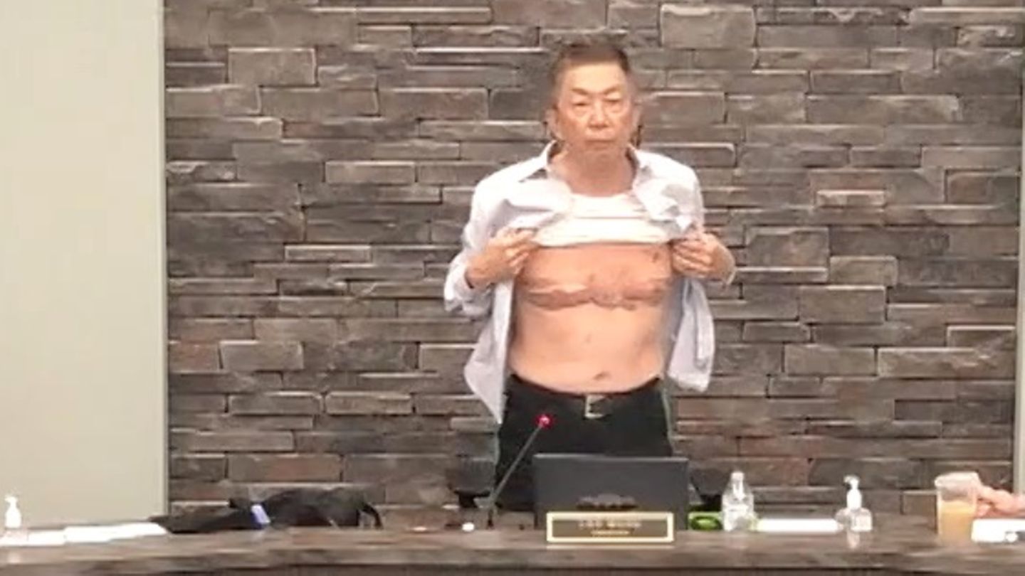 Lee Wong hebt sein Hemd und zeigt seine Narben