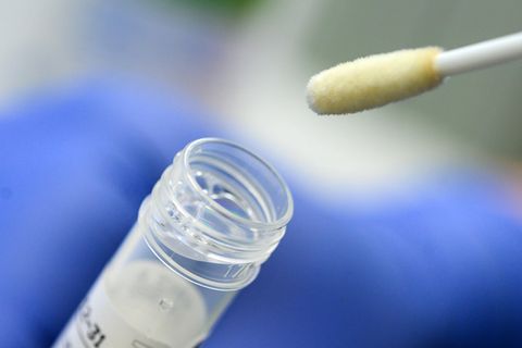 Ein Mann zeigt ein Stäbchen für einen Abstrich. Scheinbar zappeln wurmartige Gebilde über Corona-Teststäbchen. Die Verschwörungsgemeinde ist sich sicher: Das sind Morgellonen, die sich unter der Haut einnisten können. Doch es ist natürlich ganz anders.