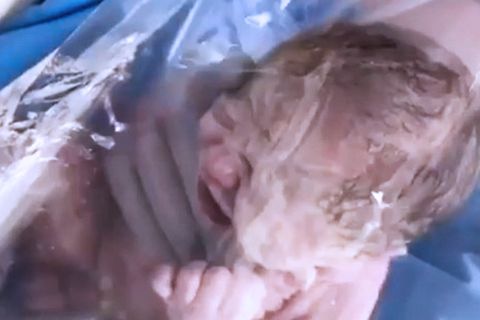 Faktencheck: Baby nach Geburt in Plastikfolie – als Corona-Schutzmaßnahme?