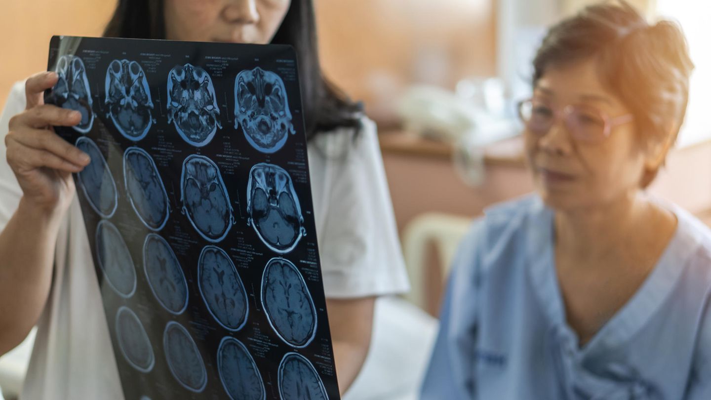 CT Scan