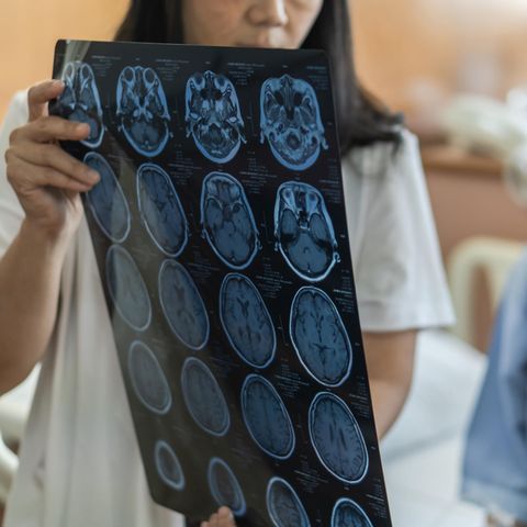 CT Scan