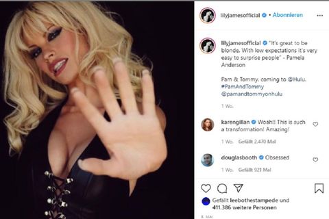 Lily James als Pam Anderson