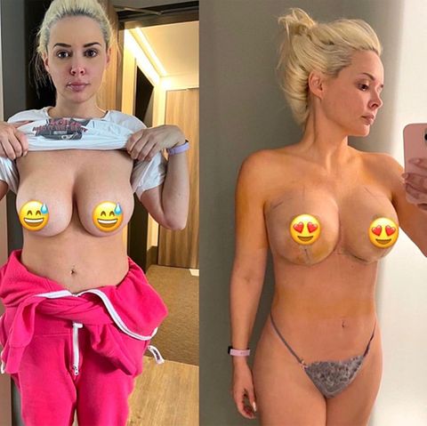 Daniela Katzenberger lässt sich die Brüste straffen