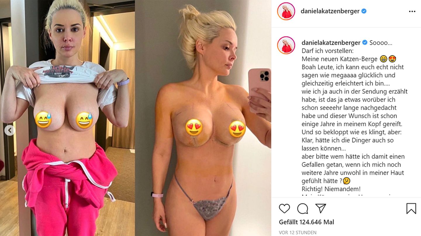 Daniela Katzenberger lässt sich die Brüste straffen