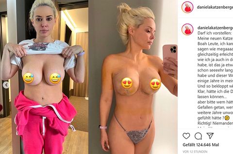 Daniela Katzenberger lässt sich die Brüste straffen