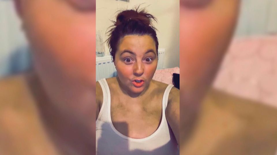 Frau nutzt abgelaufenen Selbstbräuner - und wird grün statt braun.