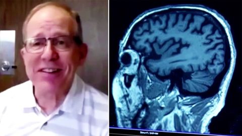 Alzheimer-Forschung: In der Früherkennung liegt die größte Chance
