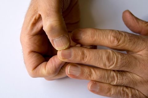 Führt Corona zu Veränderungen der Nagelstruktur