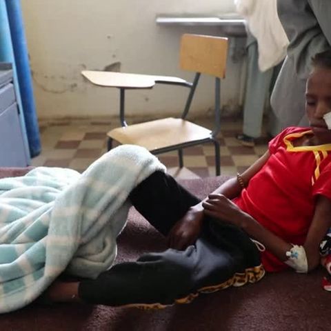 Kinder vollkommen unterernährt: UN senden Alarmsignal an die Welt: 350.000 Menschen in Äthiopien vom Hungertod bedroht