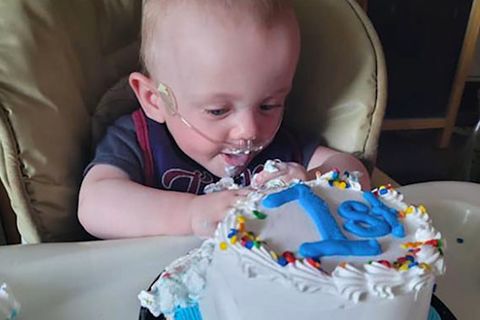 Frühchen Robert Hutchinson überlebt und feiert seinen ersten Geburtstag, obwohl er 131 Tage zu früh zur Welt kam.