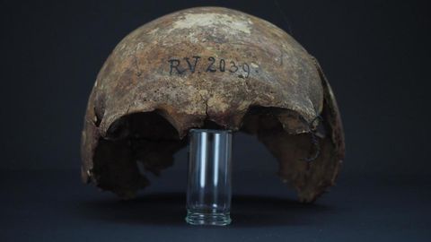 Schwarzer Tod : Patient Zero: Vor 5000 Jahre starb das älteste bekannte Pestopfer