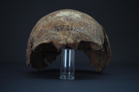 Schwarzer Tod : Patient Zero: Vor 5000 Jahre starb das älteste bekannte Pestopfer