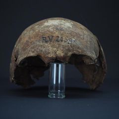 Schwarzer Tod : Patient Zero: Vor 5000 Jahre starb das älteste bekannte Pestopfer