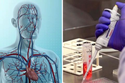 Erster Long-Covid-Patient mit Herz-Medikament geheilt