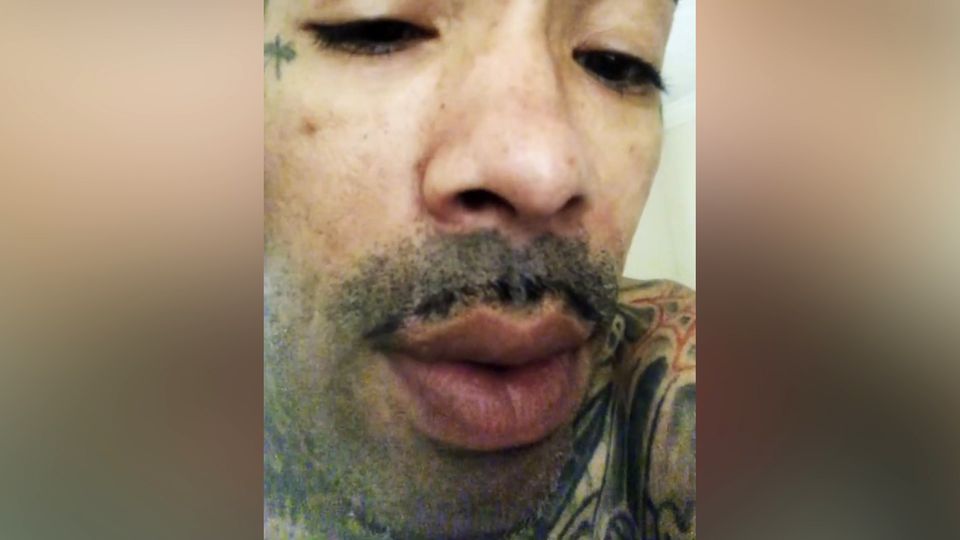 US-Rapper GUNPLAY zeigt Langzeitfolgen seines Kokainkonsums