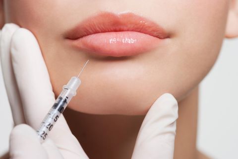 Einer Frau wird ein Medikament in die Lippe gespritzt
