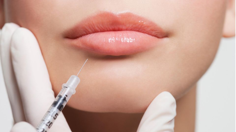 Einer Frau wird ein Medikament in die Lippe gespritzt