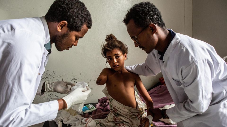 Lage in Tigray: Ärzte wechseln den Verband der zwölfjährigen Genet, einer von über 180 Verletzten des Bombardements Ärzte wechseln den Verband der zwölfjährigen Genet, einer von über 180 Verletzten des Bombardements