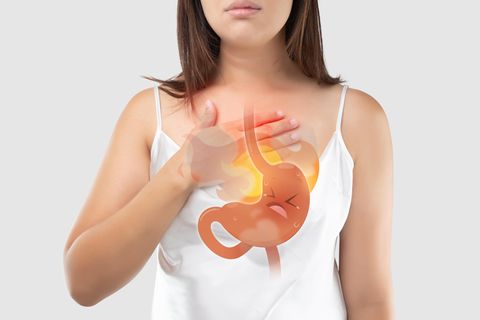 Die gesundheitlichen Probleme einer Frau aus England liegen an Achalasie.