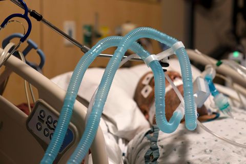 Beatmeter Patient im Krankenhaus
