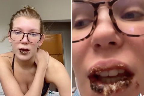 Die junge Tiktokerin hat spröde, verkrustete und schwarze Lippen aufgrund einer  Infektion mit schwarzem Pilz.