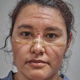 Mit seinem Foto erhielt der Fotograf Ivan Macias den zweiten Platz in der Kategorie Porträts. Das Foto zeigt eine Ärztin in Mexiko-Stadt am Ende ihrer Schicht, die Spuren einer Schutzmaske und einer Schutzbrille sind deutlich sichtbar.