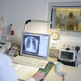 "Raucher-Screening"  Der Brustkorb wird von vorn und von der Seite oder auch in einer Computertomografie-"Röhre" (CT) geröntgt. Der Arzt sucht krebsverdächtige Stellen in der Lunge. Ergänzend wird aus den Bronchien abgehusteter Schleim (Sputum) auf veränderte oder bösartige Zellen untersucht.  Für wen angeboten?  Für Raucher ab etwa 55 Jahren.  Kosten: Röntgen ca. 50 bis 60 Euro, Computertomografie ca. 150 bis 250 Euro, Sputum-Test rund 45 bis 60 Euro.  Bewertung: Das Röntgen der Lunge hat wenig Einfluss darauf, ob man an Lungenkrebs stirbt oder nicht, weil sehr viele Tumoren nicht entdeckt werden. Bei der CT weisen erste Studien darauf hin, dass sie die Zahl der Lungenkrebstoten bei starken Rauchern leicht senken könnte. Doch noch immer fehlen wichtige Langzeitergebnisse. Röntgen, CT und Sputum-Test liefern sehr oft falsche Verdachtsbefunde. Wegen der Strahlenbelastung sind Röntgen und CT ohne Krankheitsverdacht in Deutschland rechtlich heikel. Ausnahme: im Mammografie-Screening-Programm (siehe Seite 2).  Was folgt, wenn der Arzt etwas findet?  Spiegelung der Bronchien, MRT, Gewebeprobe (Biopsie).