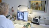 "Raucher-Screening"  Der Brustkorb wird von vorn und von der Seite oder auch in einer Computertomografie-"Röhre" (CT) geröntgt. Der Arzt sucht krebsverdächtige Stellen in der Lunge. Ergänzend wird aus den Bronchien abgehusteter Schleim (Sputum) auf veränderte oder bösartige Zellen untersucht.  Für wen angeboten?  Für Raucher ab etwa 55 Jahren.  Kosten: Röntgen ca. 50 bis 60 Euro, Computertomografie ca. 150 bis 250 Euro, Sputum-Test rund 45 bis 60 Euro.  Bewertung: Das Röntgen der Lunge hat wenig Einfluss darauf, ob man an Lungenkrebs stirbt oder nicht, weil sehr viele Tumoren nicht entdeckt werden. Bei der CT weisen erste Studien darauf hin, dass sie die Zahl der Lungenkrebstoten bei starken Rauchern leicht senken könnte. Doch noch immer fehlen wichtige Langzeitergebnisse. Röntgen, CT und Sputum-Test liefern sehr oft falsche Verdachtsbefunde. Wegen der Strahlenbelastung sind Röntgen und CT ohne Krankheitsverdacht in Deutschland rechtlich heikel. Ausnahme: im Mammografie-Screening-Programm (siehe Seite 2).  Was folgt, wenn der Arzt etwas findet?  Spiegelung der Bronchien, MRT, Gewebeprobe (Biopsie).