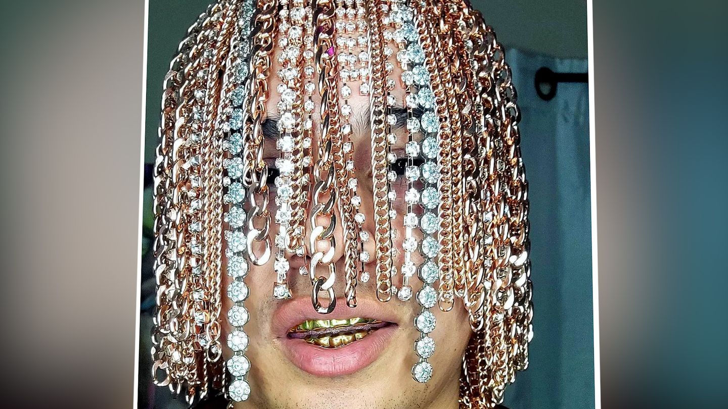 VIP-News: Rapper Dan Sur implants gold chains in his scalp