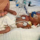 Frühchen lieben Nähe