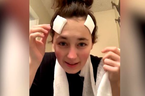 US-Amerikanischer Tiktok-Star stirbt mit nur 27 Jahren an Hautkrebs