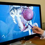 Der PSA-Test zur Krebsfrüherkennung