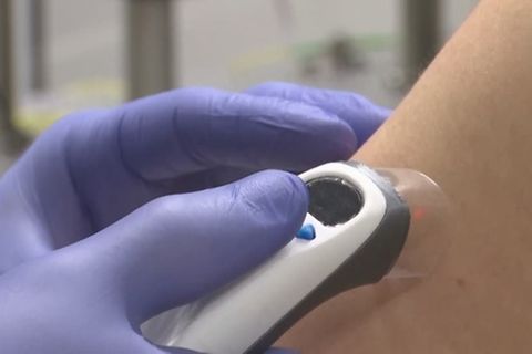 Video: Bald Spritze ohne Nadel?