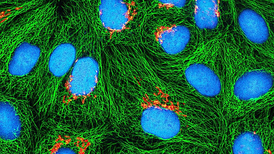 HeLa-Zellen unter einem Mikroskop